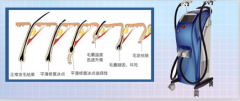 廣州脫毛儀器價(jià)格，脫毛一次多少錢(qián)，用什么儀器比較好？
